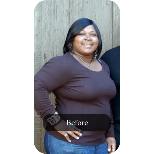 Before Weight Loss Treatments at Elara